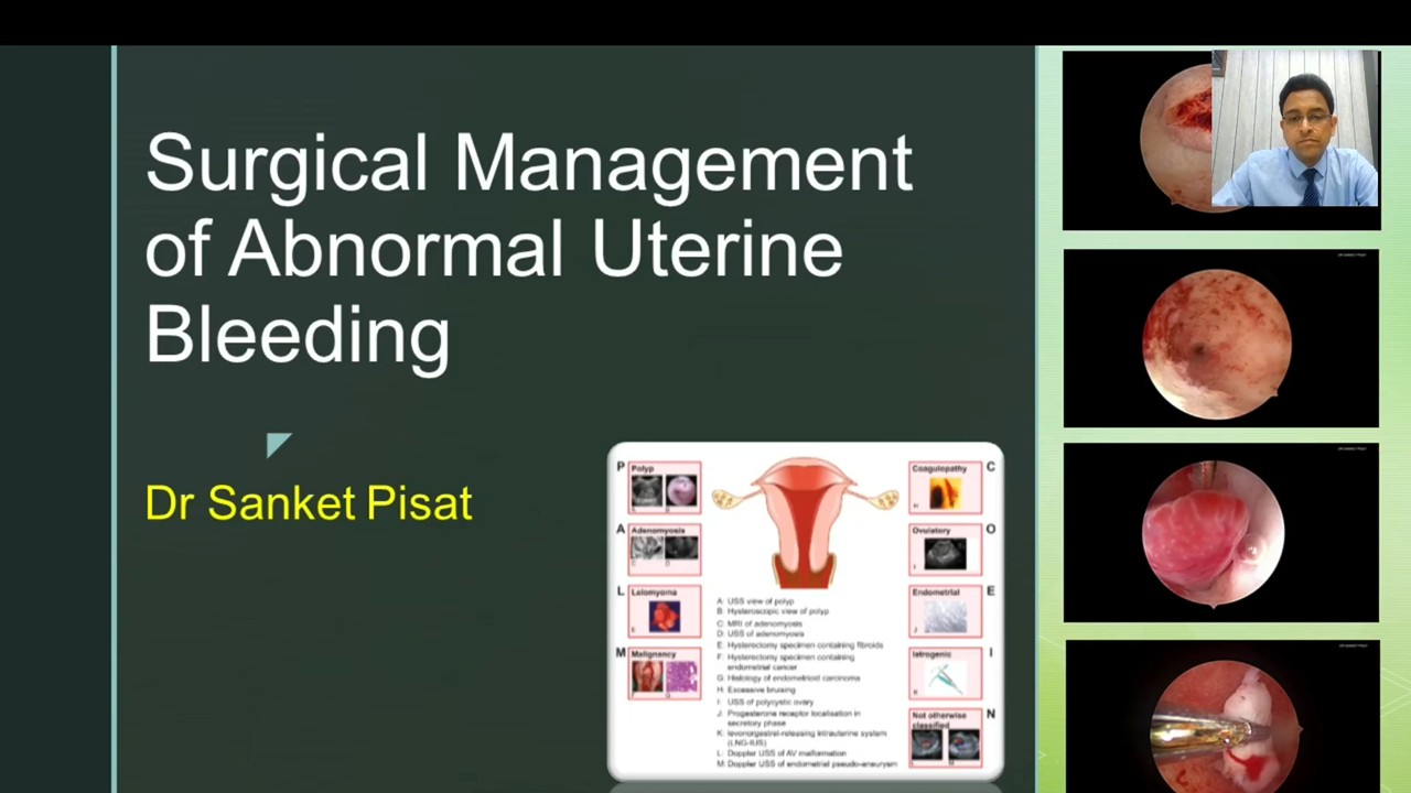 Surgical Management Of Abnormal Uterine Bleeding (CL0001)