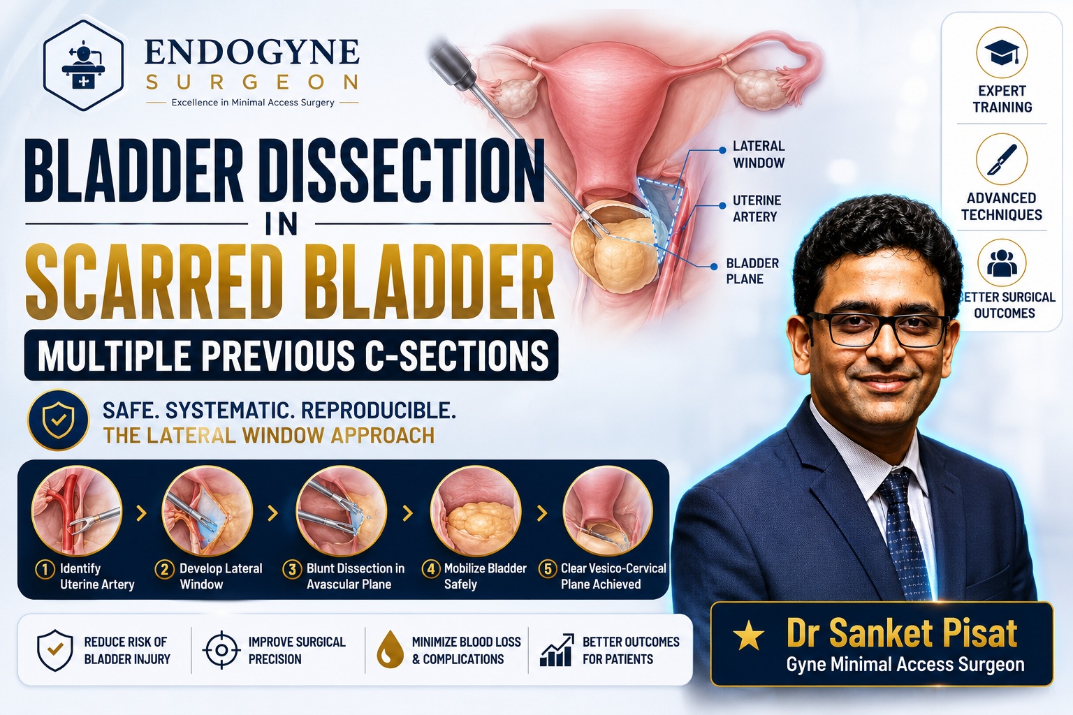 Laparoscopic Bladder Dissection for Scarred Bladder (TLH)