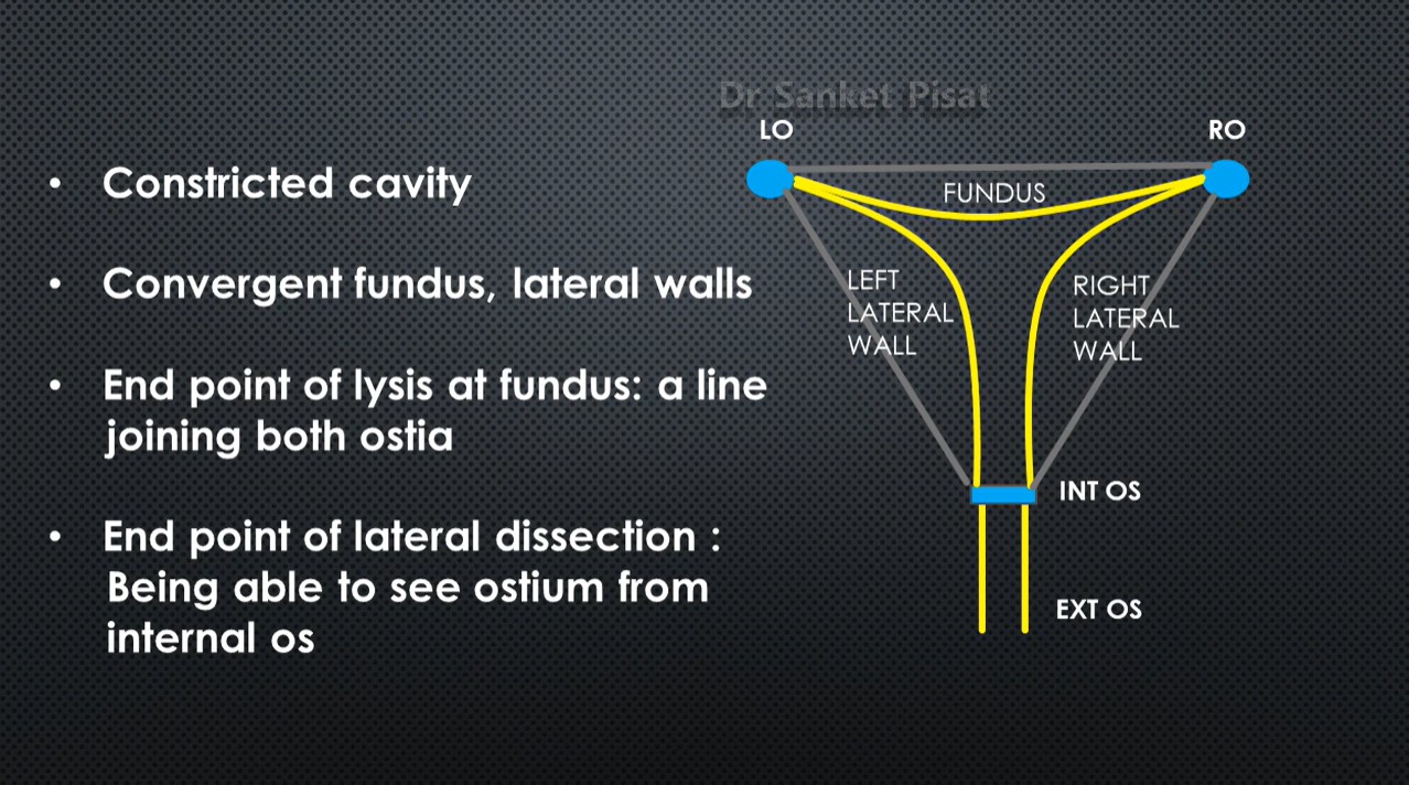 Hysteroscopic Synechiolysis Ashermans Syndrome (SS0022)